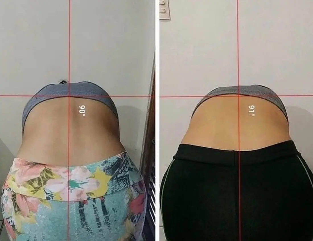 Antes e depois — postura e condicionamento