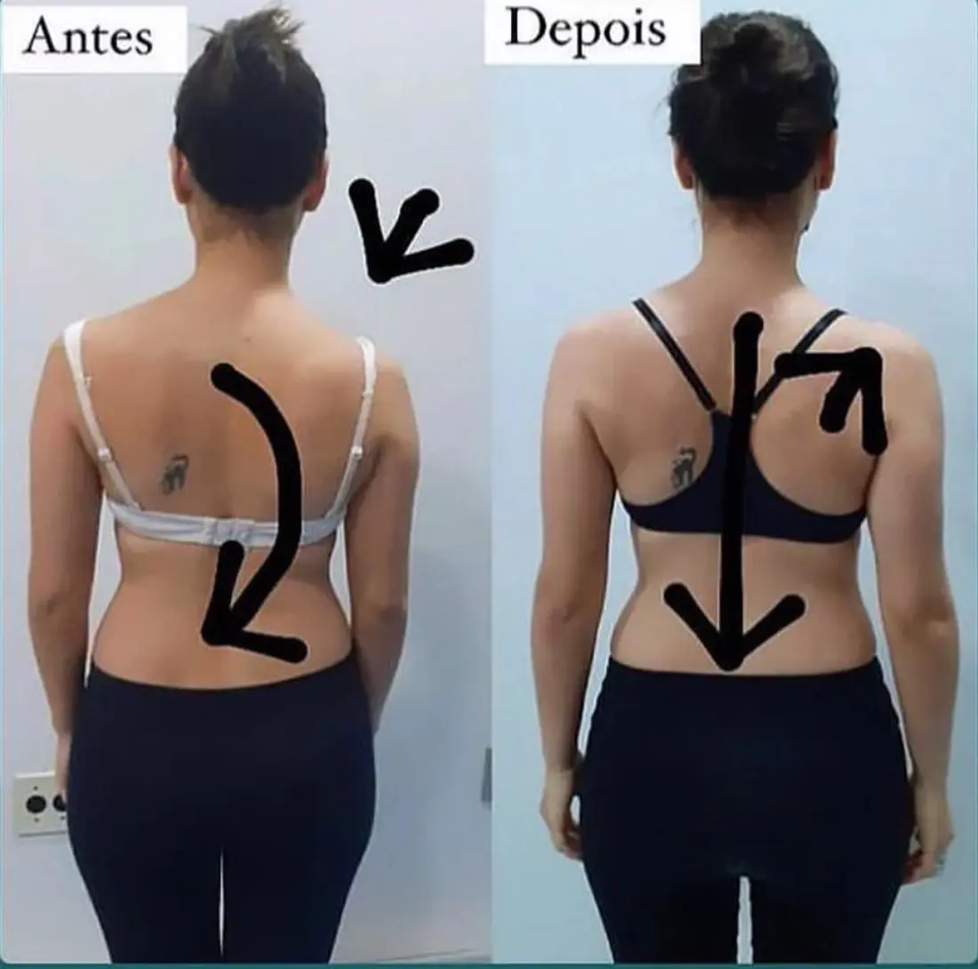 Antes e depois — correção da coluna